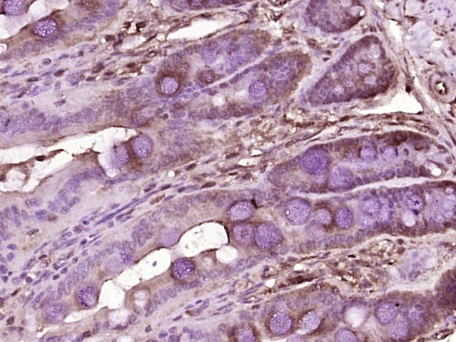 Anti-DPP4/CD26 Polyclonal Antibody