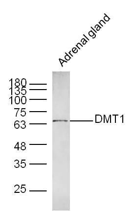 Anti-DMT1 Polyclonal Antibody