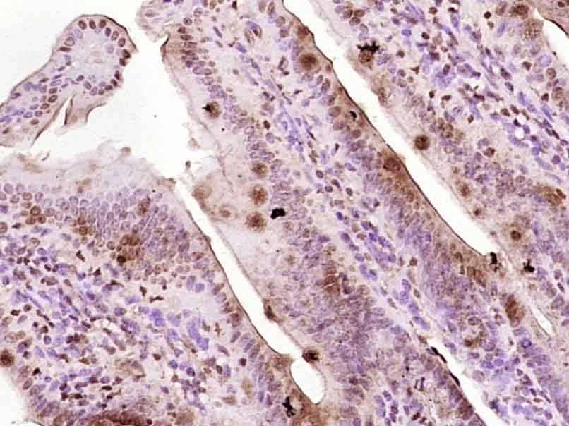 Anti-EGR1 Polyclonal Antibody