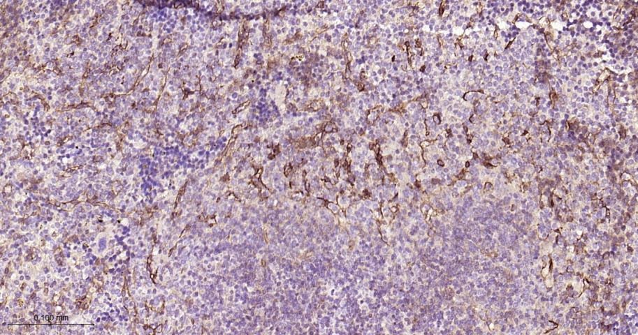 Anti-Endoglin/CD105 Polyclonal Antibody