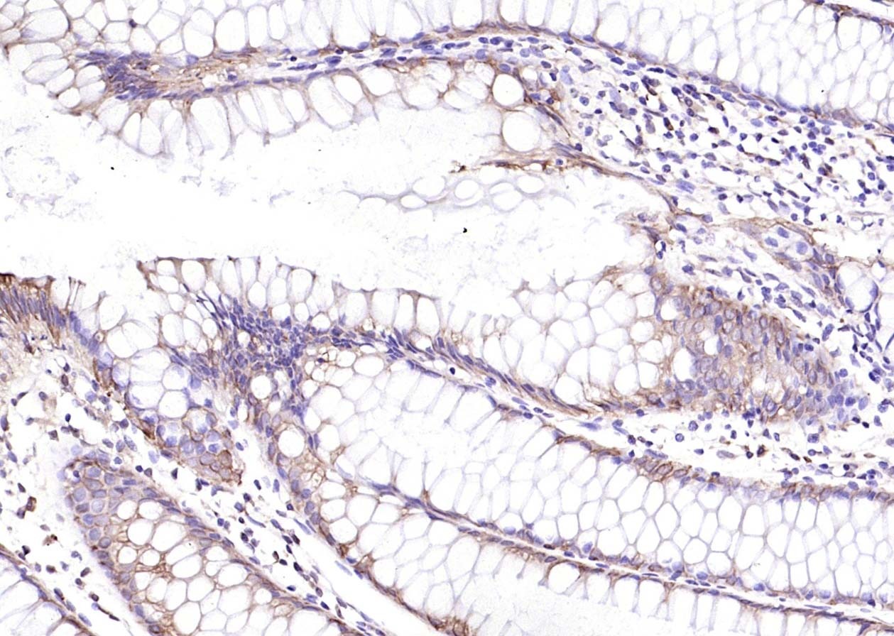 Anti-Cytokeratin 8 Polyclonal Antibody