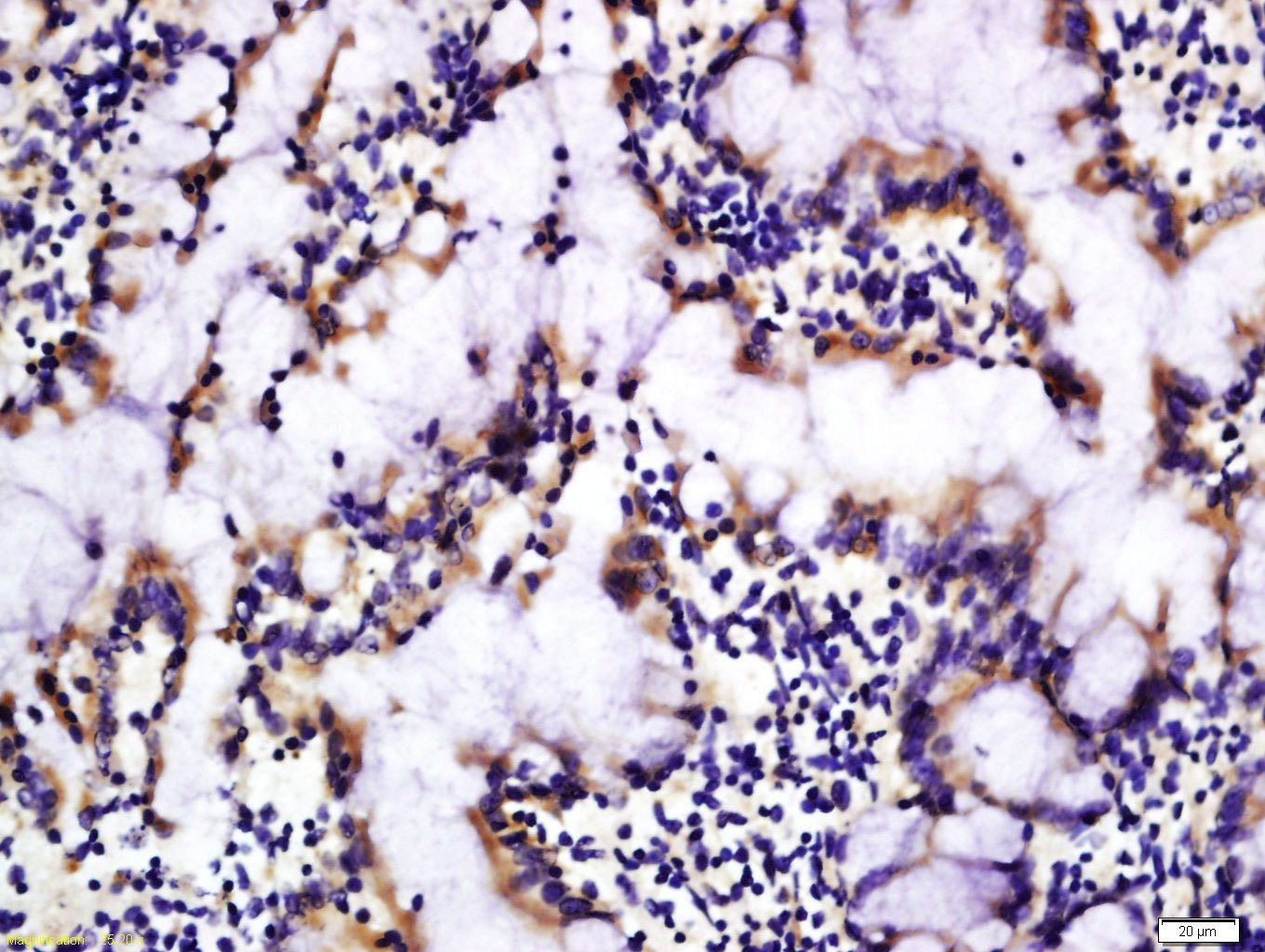 Anti-DRAM Polyclonal Antibody