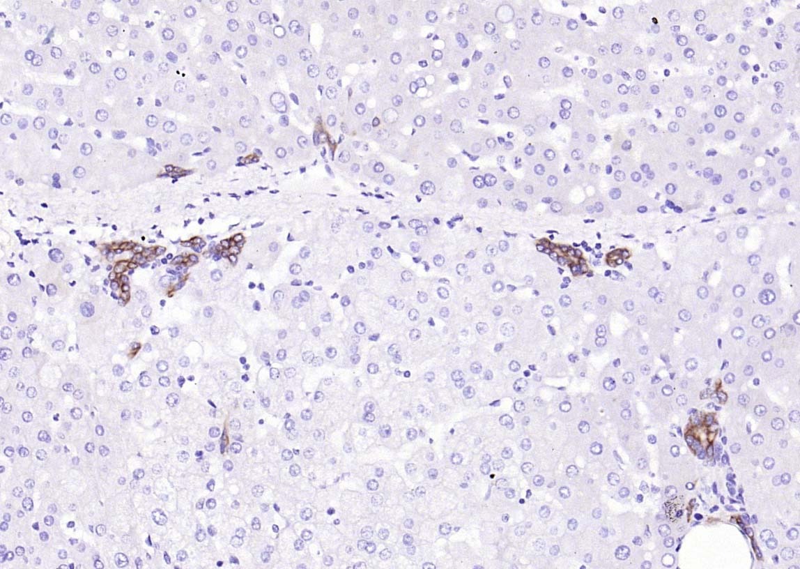 Anti-Cytokeratin 8 Polyclonal Antibody
