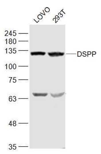 Anti-DSPP Polyclonal Antibody