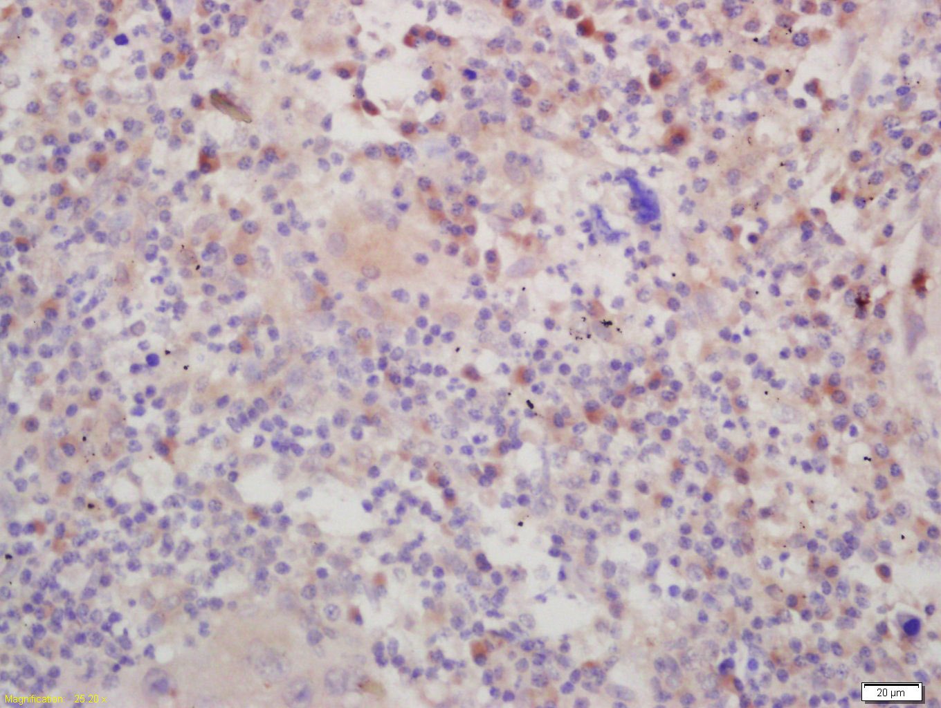 Anti-DSPP Polyclonal Antibody 2