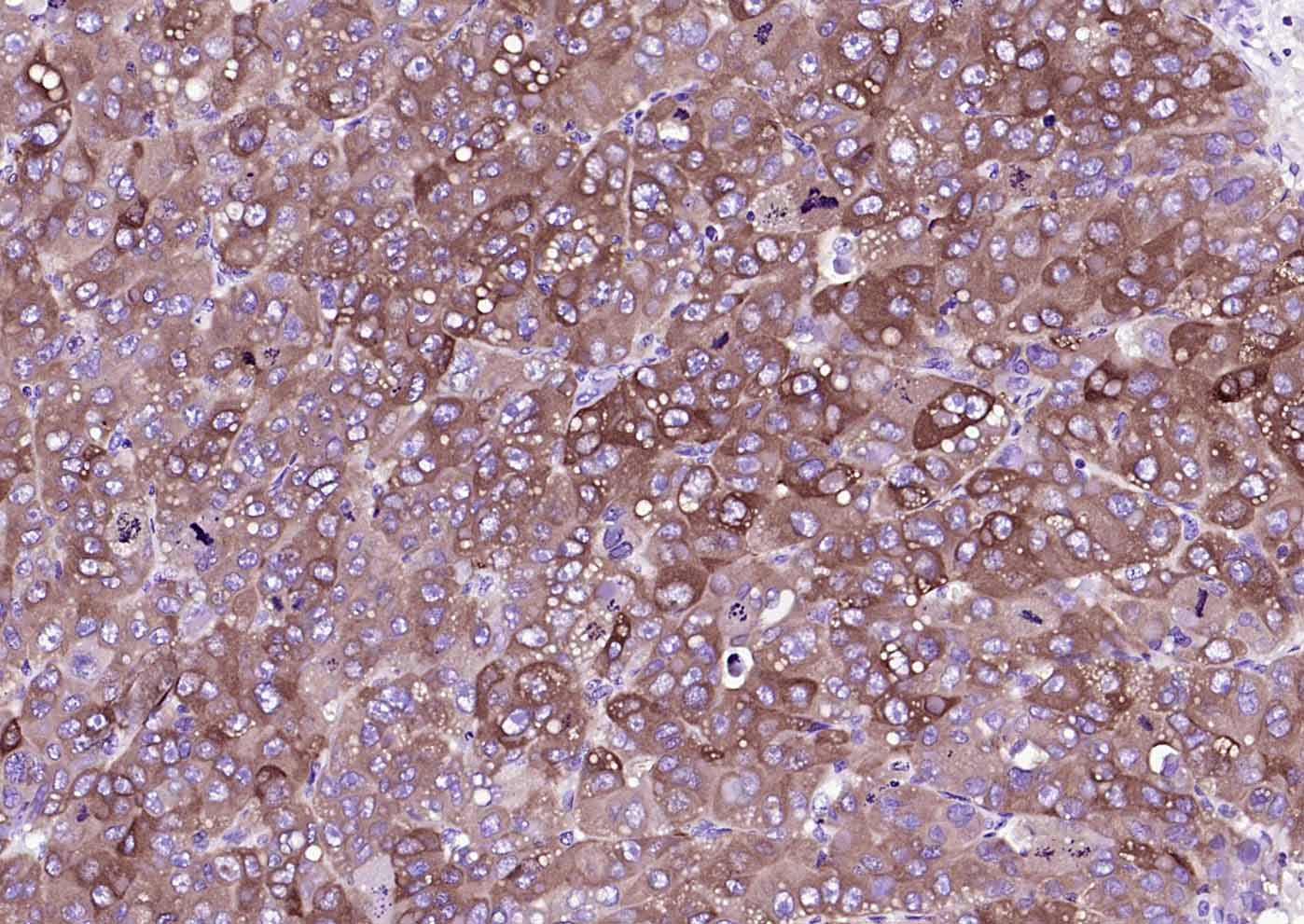 Anti-FASN Antibody (1K266)