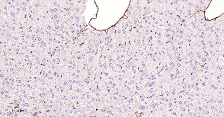 Anti-Endoglin/CD105 Polyclonal Antibody