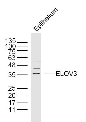 Anti-ELOV3 Polyclonal Antibody