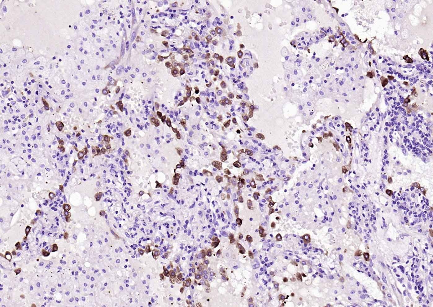 Anti-FASN Antibody (1K266)