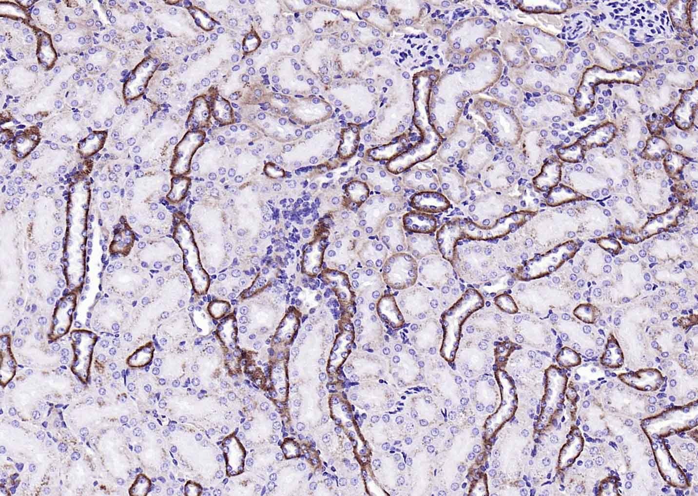 Anti-EMP-1 Polyclonal Antibody
