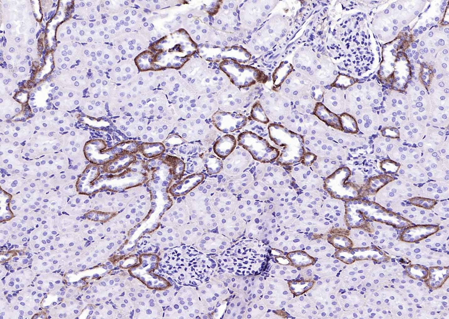 Anti-EMP-1 Polyclonal Antibody