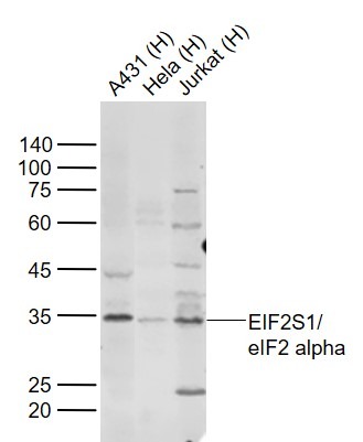 Anti-EIF2S1 Polyclonal Antibody