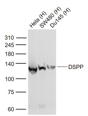 Anti-DSPP Polyclonal Antibody
