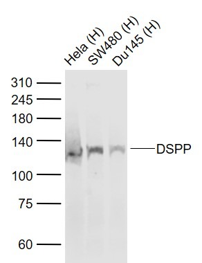 Anti-DSPP Polyclonal Antibody 2