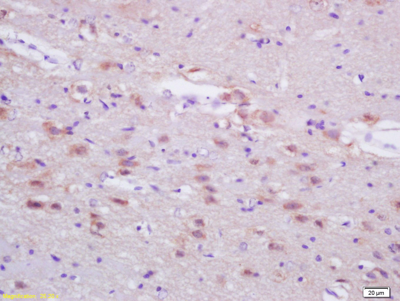 Anti-FASN Polyclonal Antibody