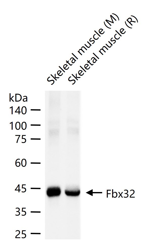 Anti-Fbx32 Antibody (4A434)