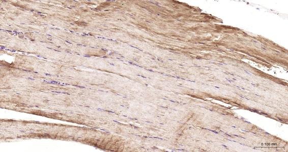 Anti-Desmin Polyclonal Antibody