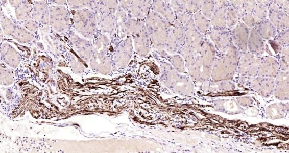 Anti-Desmin Polyclonal Antibody