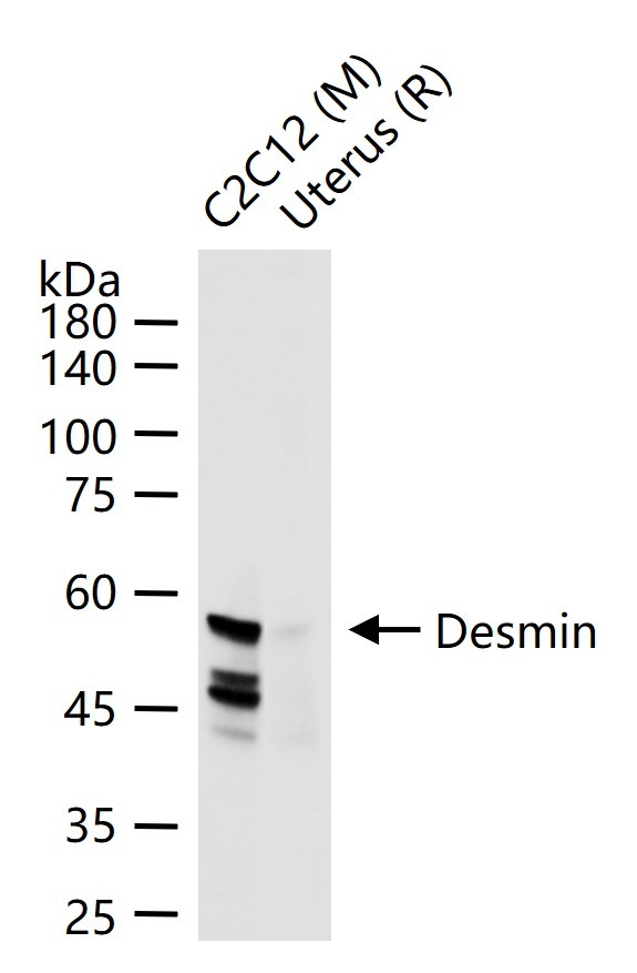 Anti-Desmin Polyclonal Antibody
