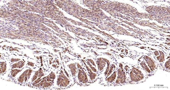 Anti-Desmin Polyclonal Antibody