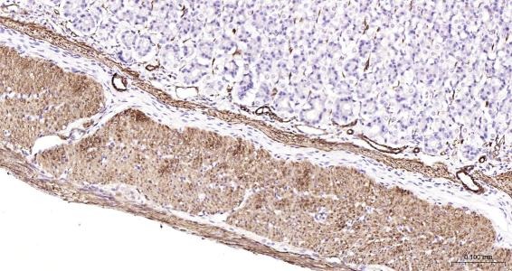 Anti-Desmin Polyclonal Antibody