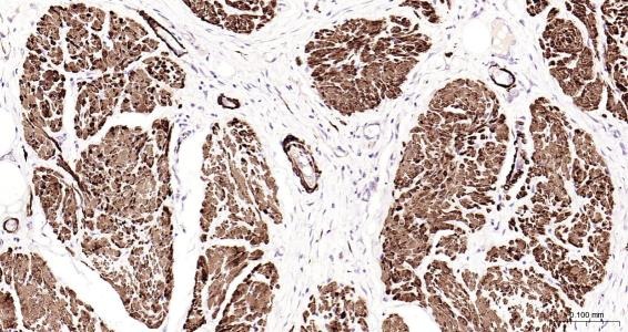 Anti-Desmin Polyclonal Antibody