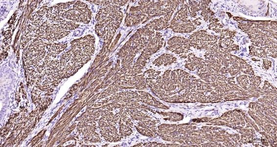 Anti-Desmin Polyclonal Antibody