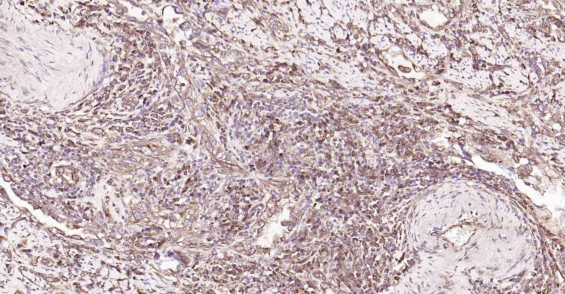 Anti-DDIT3 Polyclonal Antibody