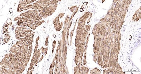 Anti-Desmin Polyclonal Antibody