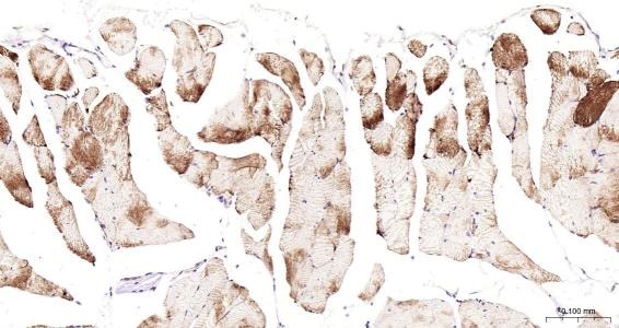Anti-Desmin Polyclonal Antibody