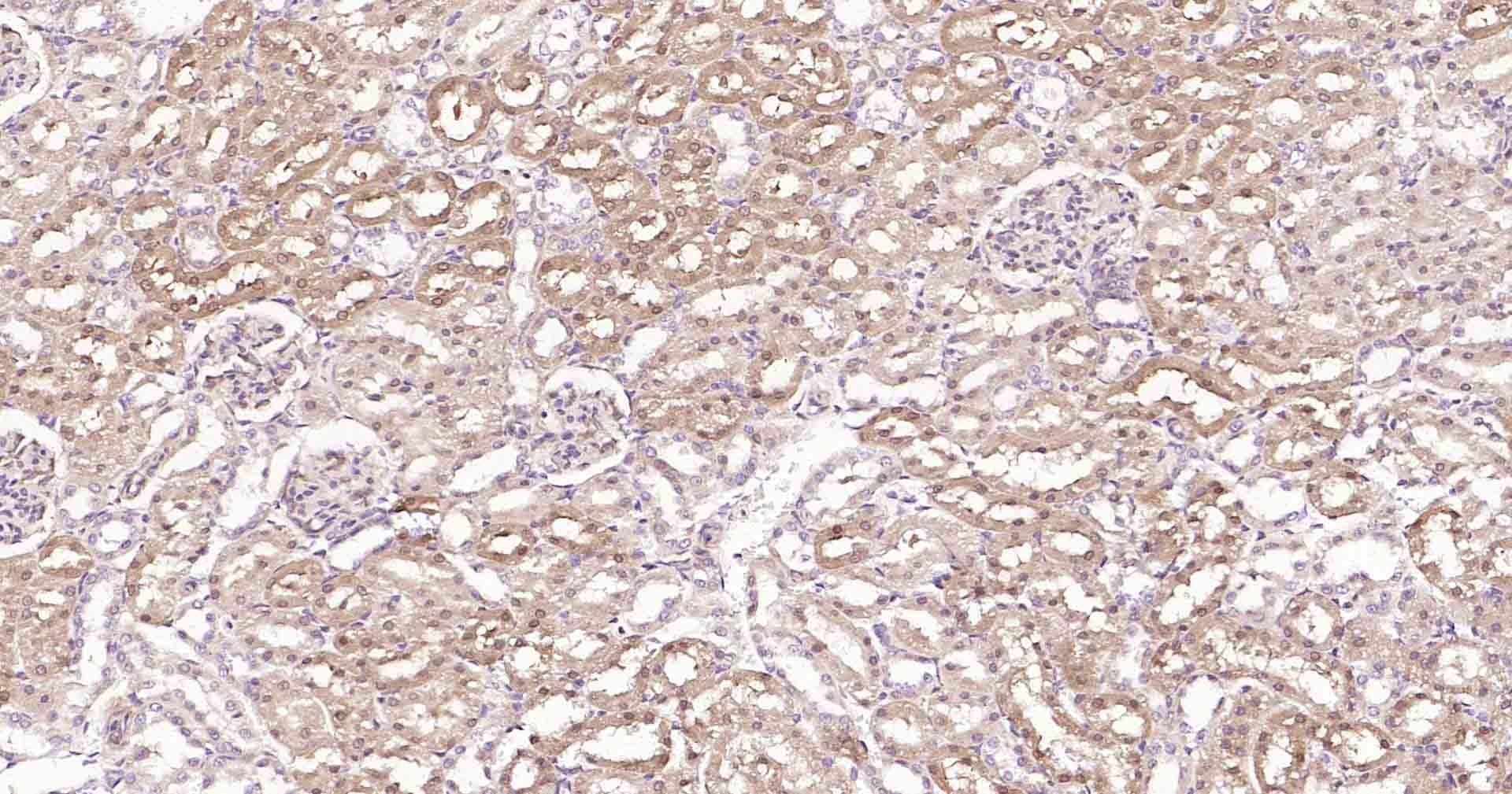 Anti-DDIT3 Polyclonal Antibody