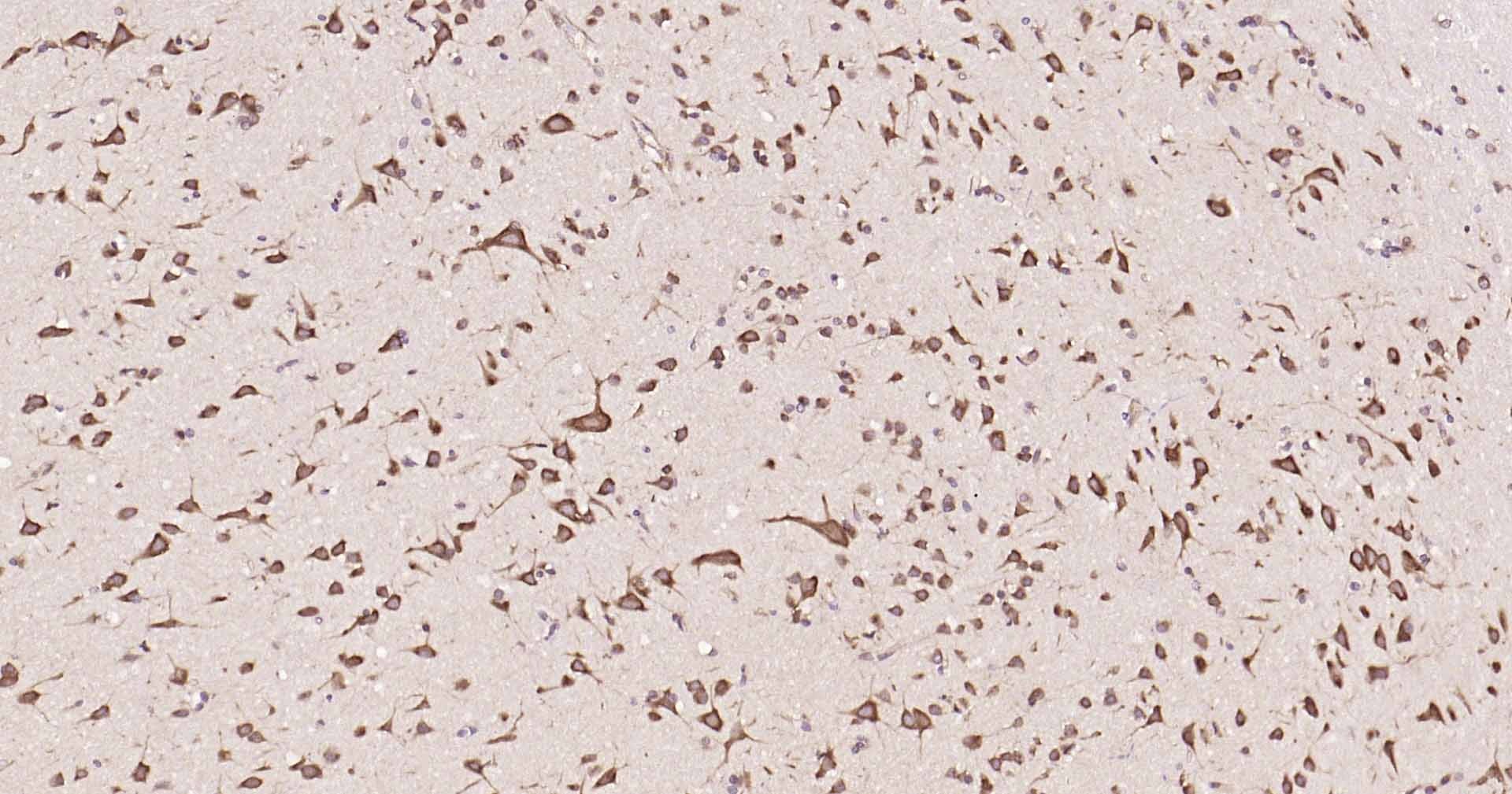 Anti-DDIT3 Polyclonal Antibody