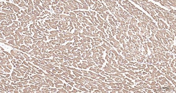 Anti-Desmin Polyclonal Antibody