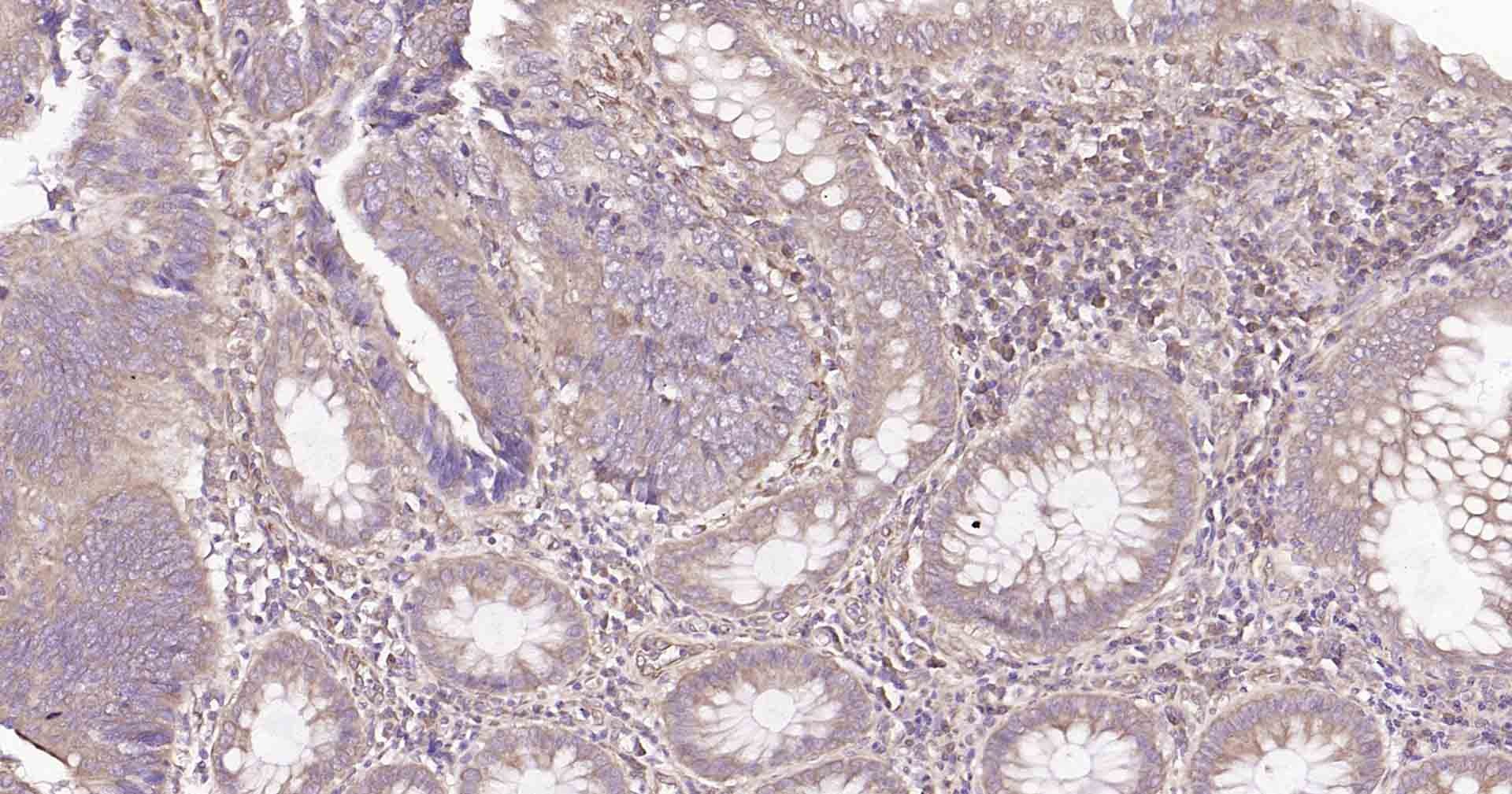 Anti-DDIT3 Polyclonal Antibody
