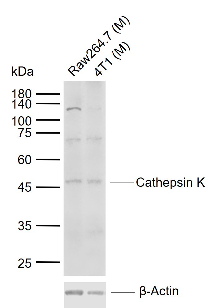 Anti-Cathepsin K Polyclonal Antibody