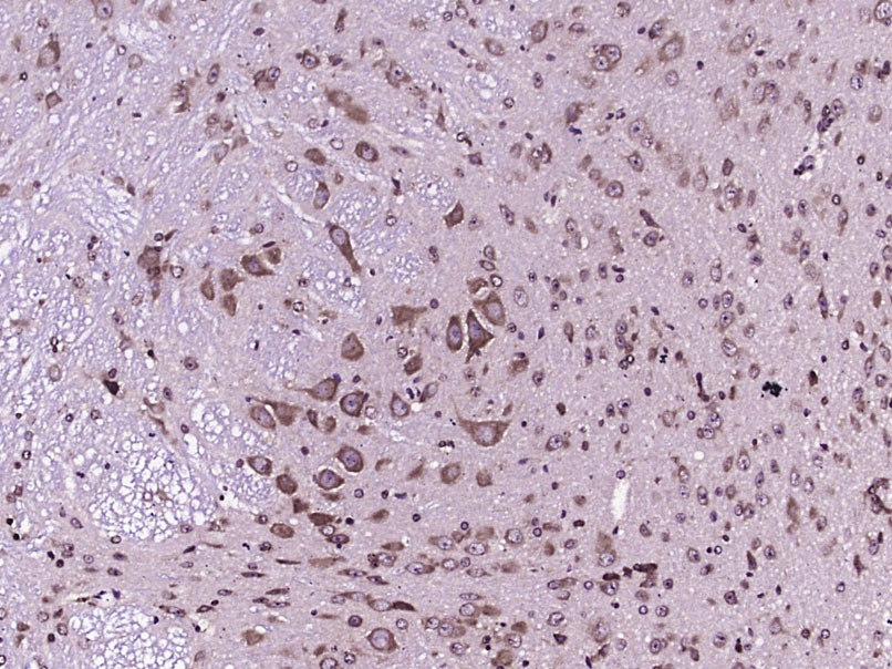 Anti-CB2/CNR2 Polyclonal Antibody