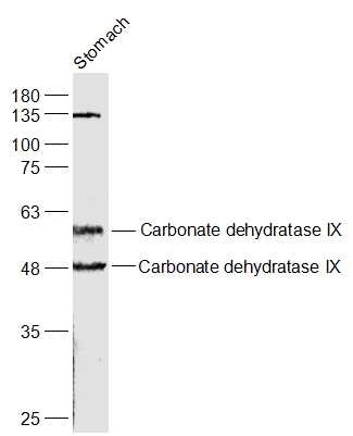 Anti-CA9/Carbonic Anhydrase IX Polyclonal Antibody