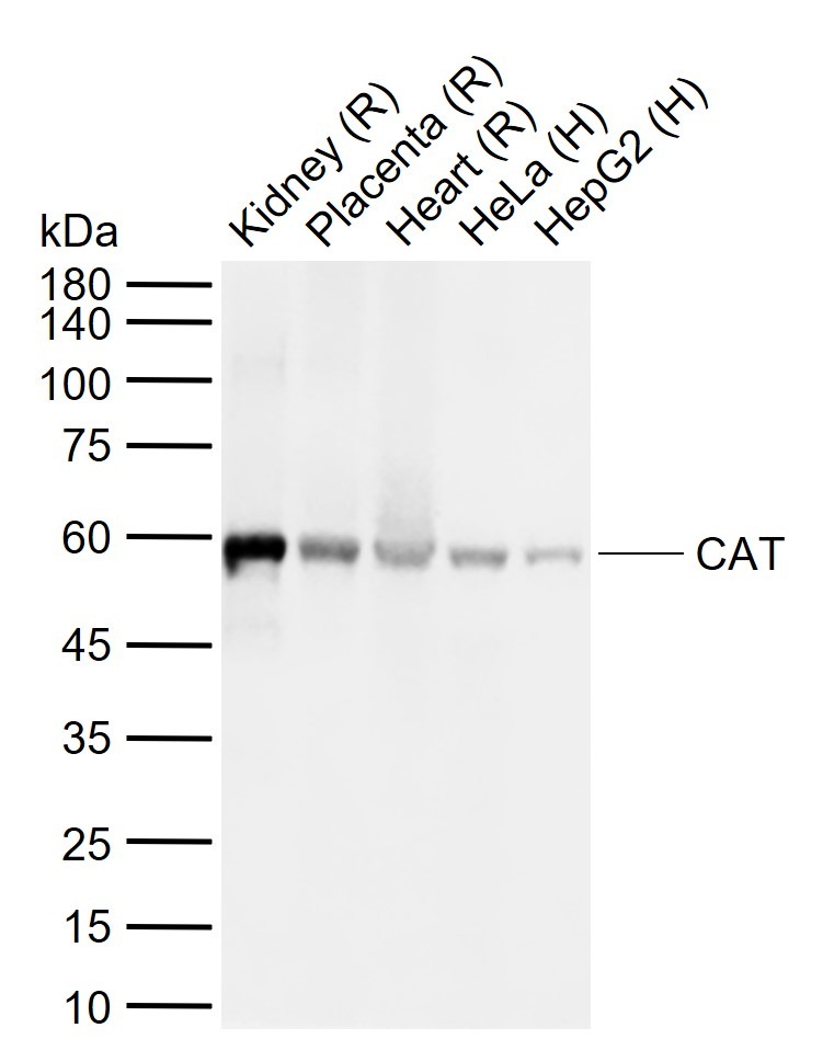 Anti-Catalase/CAT Polyclonal Antibody