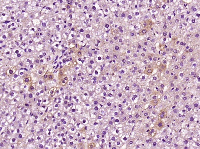 Anti-C5b-9 Polyclonal Antibody