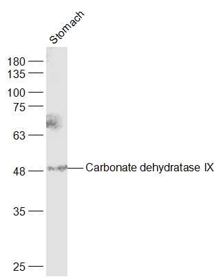 Anti-CA9/Carbonic Anhydrase IX Polyclonal Antibody