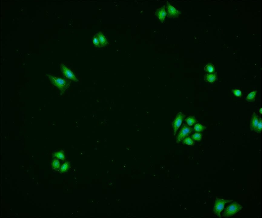 Anti-CA9/Carbonic Anhydrase IX Polyclonal Antibody