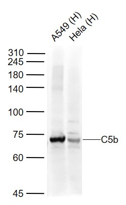 Anti-C5b-9 Polyclonal Antibody