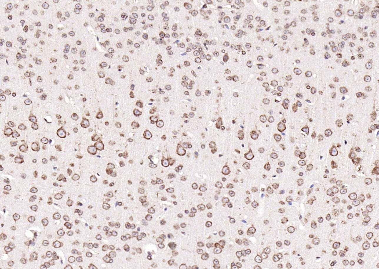 Anti-Calreticulin Antibody (6Q988)