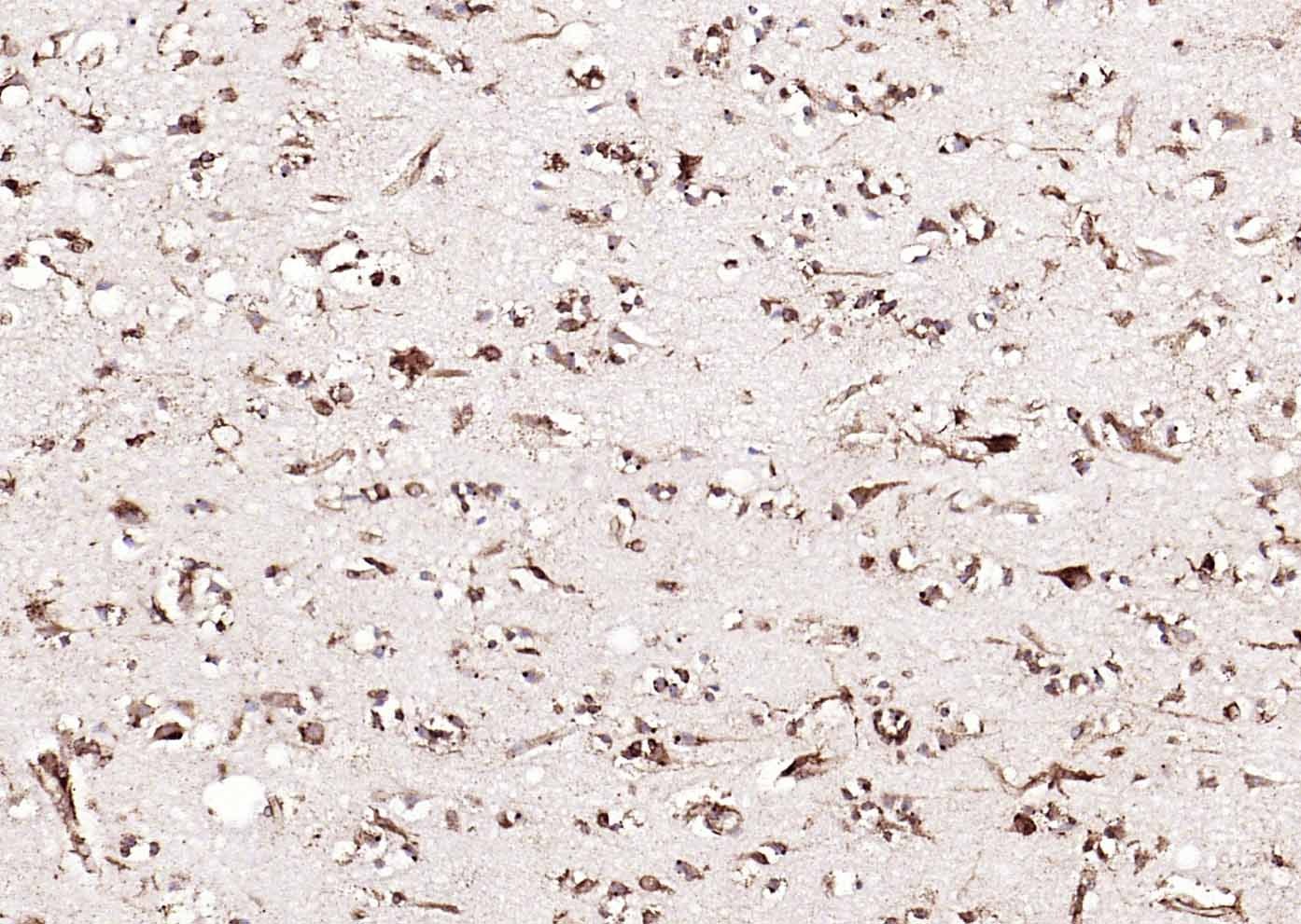 Anti-Calreticulin Antibody (6Q988)