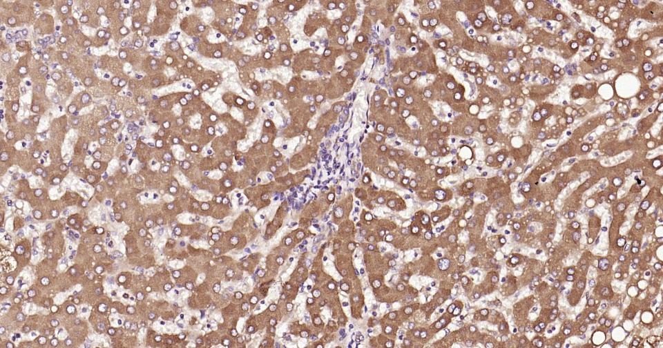 Anti-Calreticulin Polyclonal Antibody
