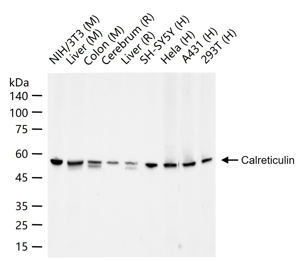 Anti-Calreticulin Antibody (3C852)
