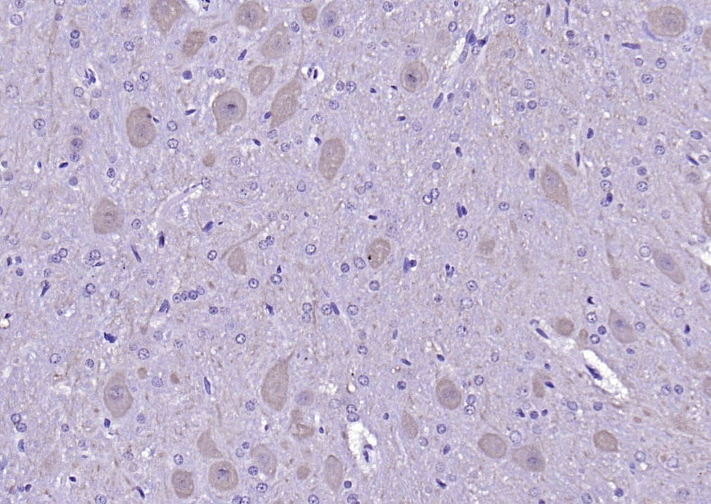 Anti-CALM1 Polyclonal Antibody