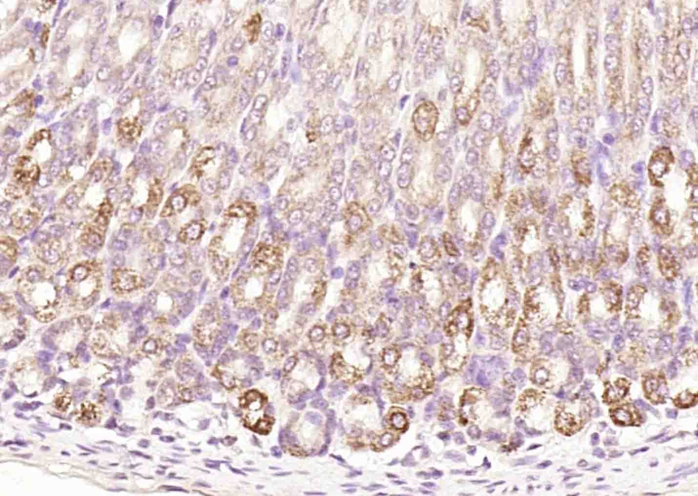 Anti-CCKBR Polyclonal Antibody