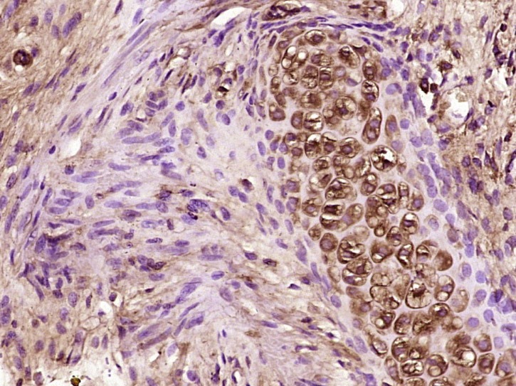 Anti-CCL26 Polyclonal Antibody