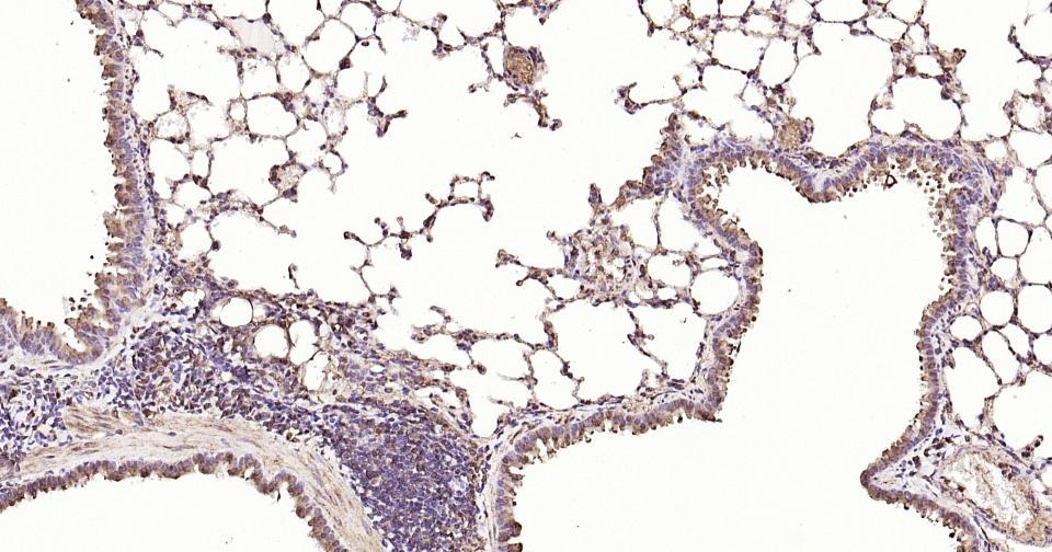 Anti-Calreticulin Antibody (3C852)